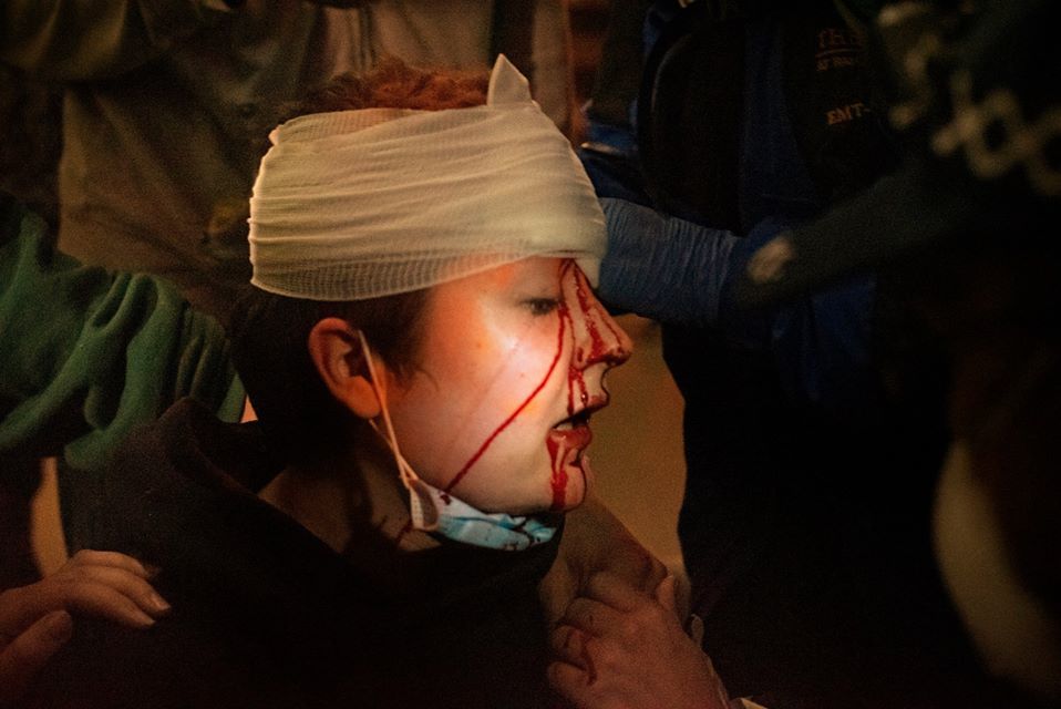 injury
