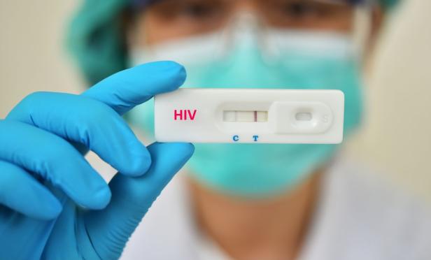 HIV Test